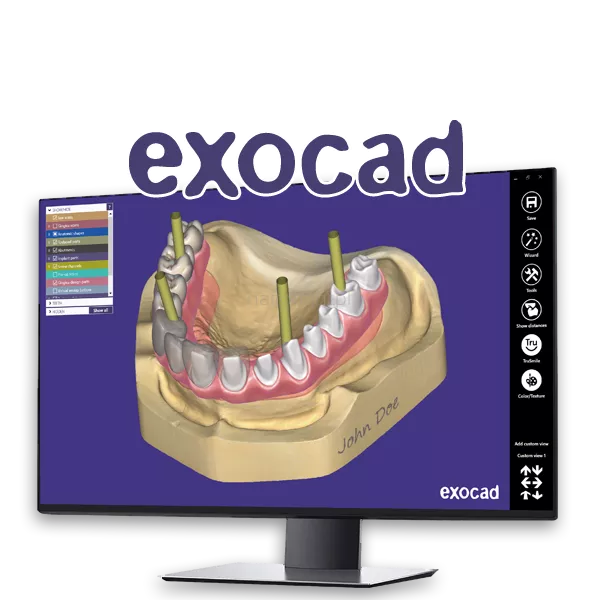 Exocad DentalCAD Core Lab Version